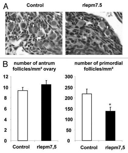 Figure 6 Effect of neonatal treatment on ovary. Representative ovary sections from control and leptin antagonist-treated rats. Arrow heads indicate primordial follicles. Bars 10 µm. (B) Number of antrum and primordial follicles relative to ovary area in control and rlepm7.5 animals. Values represent the mean ± SEM, n = 5 and n = 8 in the control and rlepm7.5 groups, respectively. *p < 0.05 between control and rlepm7.5 animals.
