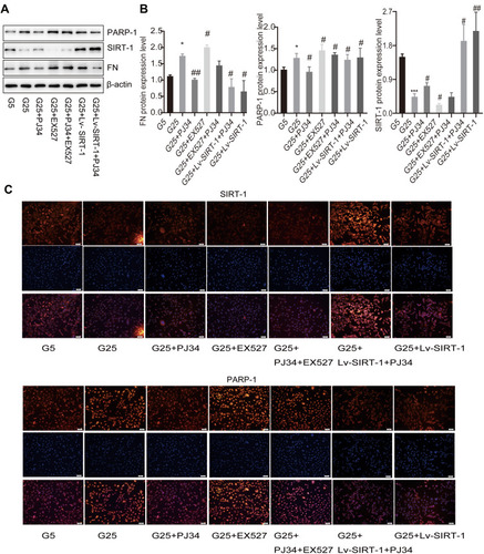 Figure 2 The effect of PARP-1 and SIRT-1 in MCs. (A and B) Proteins expression in MCs in high glucose condition or low glucose condition incubated with different reagents by Western blotting. β-Actin was used as control of protein loading. Bars represent mean ± SD of three independent experiments. *Compared with G5, P < 0.05; ***compared with G5, P < 0.001. #Compared with G25, P < 0.05; ##compared with G25, P < 0.01. (C) Immunofluorescence images showed the change of protein SIRT-1 and PARP-1 expression in different MCs groups. Blue, nuclear staining (DAPI); green, target protein staining. Images were analyzed by confocal microscopy under a 50-μm ruler.