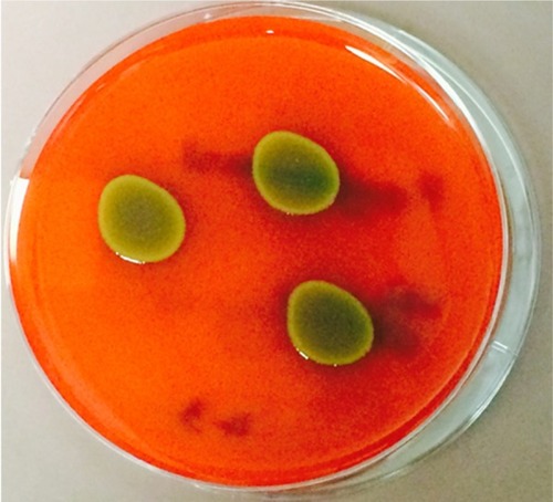 Figure 1 Growth of Pantoea agglomerans on a blood agar culture plate.