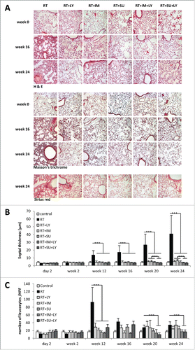 Figure 3. Combined PDGF and TGFβ signaling inhibition reduce radiation-induced thickening of pulmonary septa and invasion of inflammatory cells. (A) Sample images of treated mouse lungs stained with hematoxylin-eosin, Masson's trichrome and Sirius red. (B) Average thickness of mouse pulmonary septa after irradiation and treatment with galunisertib (LY), imatinib (IM) or SU9518 (SU). (C) Quantification of leukocyte infiltration of irradiated mouse lungs. Graphs depict mean values +/− SD. Statistical analysis was performed by Student's t-test; ***p < 0.001.