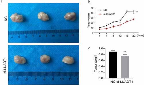 Figure 6. lncRNA-LUADT1 effect on tumor growth in nude mice