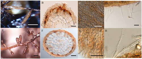 Figure 3. Macro-morphological and anatomical characteristics of Tuber huidongense mycorrhizae with Quercus acutissima (A–D) and Q. dentata (E–H). (A, E) Shape of mycorrhizal root tips. (B, F) Cross-section of mycorrhizal root tips. (C, G) Outer mantle surface structure. (D, H) Separate hyphae emanating from the outer mantle layer. (Scale bars: A, E = 1 mm; B, F = 20 μm; C, D, G, H = 50 μm).