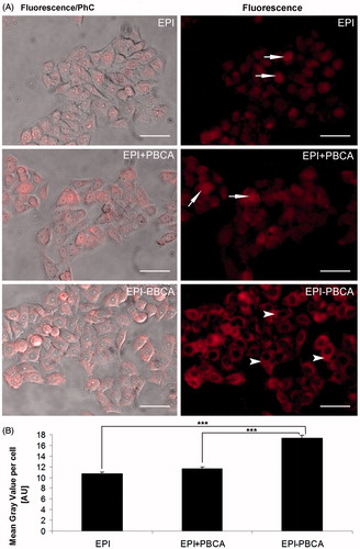 Figure 3. Uptake of epirubicin formulations by HeLa cells. (A) Representative images of epirubicin treated cells. Left column represents phase contrast (PhC) images overlaid with the fluorescent signal. Right column shows the fluorescent images only. Arrows indicate predominant nuclear localization, arrowheads indicate predominant cytoplasmic localization. Scale bar: 50 µm. (B) Uptake of epirubicin formulations by HeLa cells. Graph indicates the average mean gray value per cell, measured with ImageJ software. ***p < 0.001.
