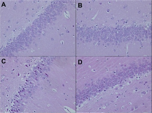 Figure 2 Pathological changes in the hippocampus of rats in each group on day 7 after Aβ injection (original magnification × 400). (A) Control group; (B) atorvastatin control group; (C) AD group; and (D) atorvastatin-treated AD group.