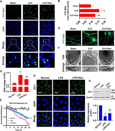Figure 7 Effects of Dex on vascular leakage in sepsis. (A and B) Vascular permeability of the lung, measured by the optical density of injected FITC-BSA in vivo (Bar, 50μm), n=8. (C) The FITC-BSA leakage of mesentery micro-vessels in rats, measured by inverted intravital microscopy in vivo (Bar, 100μm), n=6. (D) The infiltration rate of FITC-BSA in VECs in sepsis, n=3. (E) Effects of Dex on the TER of VEC monolayers in sepsis, n=3. (F) Representative transmission electron microscope microphotographs of tight junctions of pulmonary venules (Bar, 200nm), n=6. (G) The expression of ZO-1 (green) in VECs was measured by immunofluorescence (Bar, 10μm), n=3. (H) Effects of Dex on the level of ZO-1 detected by Western Blotting, n=3. a: P<0.05 compared with the sham or normal group, b: P<0.05 compared with CLP or LPS group.