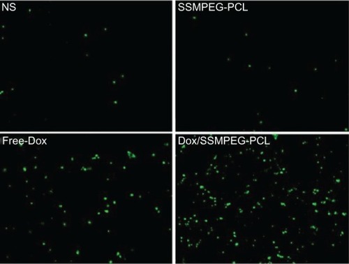 Figure 10 Detection of apoptotic tumor cells by TUNEL assay.Notes: The assay confirmed that Dox/SSMPEG-PCL (5 mg/kg) induced more cancer cell apoptosis than did saline (NS), empty SSMPEG-PCL micelles (SSMPEG-PCL), and free Dox (5 mg/kg). This indicated that Dox/SSMPEG-PCL induced more cancer cell apoptosis than free Dox, in vivo.Abbreviations: TUNEL, terminal deoxynucleotidyl transferase dUTP nick end labeling; Dox/SSMPEG-PCL, doxorubicin-loaded star-shaped monomethoxy poly (ethylene glycol)-poly(å-caprolactone); SSMPEG-PCL, star-shaped monomethoxy poly (ethylene glycol)-poly(å-caprolactone); Dox, doxorubicin.