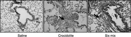 FIG. 1 Gomori Trichrome-stained 7 μ M sections of mouse lungs from animals instilled with saline, Six-mix, and crocidolite asbestos for comparison (200X original magnification). Green staining indicates collagen deposition, also indicated with a bold arrow.