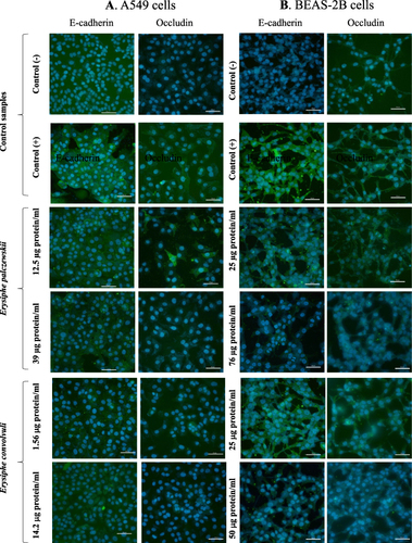 Figure 8 Effect of the E. palczewskii and E. convolvuli extracts on the presence of E-cadherin and occludin in the A549 (A) and BEAS-2B (B) cells (representative photos from three independent replicates). Control (-) - fungal extract-untreated cells incubated with secondary antibody only; Control (+) - fungal extract-untreated cells incubated with primary and secondary antibody. Cell nuclei stained with DAPI (blue). Bars: 50 µm.