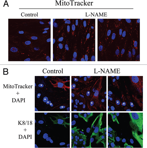 Figure 14 Rescue of mitochondrial dysfunction with L-NAME, an inhibitor of NO production. (A) L-NAME increases mitochondrial activity. hTERT-fibroblasts were treated for 24 hours with 20 mM L-NAME or vehicle alone (H2O) before incubation with MitoTracker (red). DAPI was used to stain nuclei (blue). Note that L-NAME treatment greatly increases mitochondrial activity. Original magnification, 63x. (B) L-NAME abrogates the mitochondrial phenotypes in co-cultured cells. hTERT-fibroblast-MCF7 cell co-cultures were incubated with 20 mM L-NAME or vehicle alone (H2O) control for 24 hours. Then, cells were incubated with MitoTracker (red), fixed and immunostained with anti-K/18 (green) antibodies. DAPI was used to stain nuclei (blue). Note that upon L-NAME treatment, mitochondrial activity is increased in fibroblasts and decreased in MCF7 cells. Stars denote fibroblast nuclei. Upper panels show only the red channel to appreciate the MitoTracker staining, while the lower panels show the merged images of K8/18 and DAPI. Importantly, images were acquired using identical exposure settings. Original magnification, 40x.