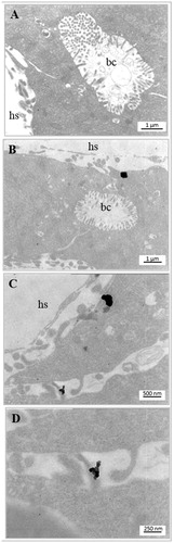 Figure 9. Electron microscopy imaging of the X. laevis liver. Bile canaliculus (bc) and hepatic sinusoid (hs) of control (A) and exposed to 25 mg Fe/L of Fe3O4 NPs (B–D) embryos. NPs aggregates in treated embryos are clearly visible in sinusoidal space and within hepatocytes (B, C). (D) High magnification of C.