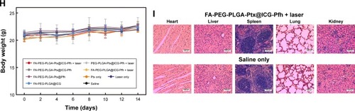 Figure 5 In vivo anticancer therapy.Notes: (A) Monitoring images of MDA-MB231 tumor-bearing mice in laser-irradiation groups during PTT by thermal imaging. (B) Temperature of tumor region in laser-irradiation groups during PTT. (C) TUNEL and Ki67 expression in tumor tissue by immunohistochemical staining. Nuclei, stained in brown, are from TUNEL-positive or Ki67-positive cells, with blue indicating negative (FA-PEG-PLGA-Ptx@ICG-Pfh NPs with laser irradiation [i], PEG-PLGA-Ptx@ICG-Pfh NPs with laser irradiation [ii], FA-PEG-PLGA-Ptx@ICG-Pfh NPs without laser irradiation [iii], FA-PEG-PLGA@ICG-Pfh NPs with laser irradiation [iv], FA-PEG-PLGA-Ptx@Pfh without laser irradiation [v], Ptx only [vi], FA-PEG-PLGA@ICG without laser irradiation [vii], laser only [viii], saline [ix]). (D) Positive index of TUNEL assay for FA-PEG-PLGA-Ptx@ICG-Pfh NPs with laser irradiation was higher than that in the other eight groups (P<0.05). (E) Ki67 expression for FA-PEG-PLGA-Ptx@ICG-Pfh NPs with laser irradiation was lower than that of the other eight groups (P<0.05). (F) Relative tumor-volume curves of different groups of MDA-MB231 tumor-bearing mice. (G) Typical MDA-MB231 tumor-bearing mice having received FA-PEG-PLGA-Ptx@ICG-Pfh with laser irradiation on different days. (H) Body weight of mice was measured during the 14 observation days in different groups. (I) H&E-staining images of major organs collected from the FA-PEG-PLGA-Ptx@ICG-Pfh NPs with laser irradiation and saline only (control) groups. *P<0.05 significant difference FA-PEG-PLGA-Ptx@ICG-Pfh compared with other groups.Abbreviations: PTT, photothermal therapy; FA, folic acid; PEG, polyethylene glycol; PLGA, poly(lactide-co-glycolic acid); Ptx, paclitaxel; ICG, indocyanine green; Pfh, perfluorohexane; NPs, nanoparticles.