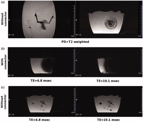 Figure 21. The magnitude of MR images (a) proton density + T2-weighted images in middle-coronal and axial plane, without connector. (b) The echo time images in the axial plane, with connector. (c) The echo time images in the axial plane, without connector.