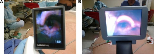 Figure 3 Images obtained from the same patient with two devices.