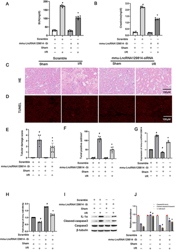 Figure 8 Knockdown of mmu-lncRNA 129814 ameliorates I/R-stimulated AKI progression by targeting the miRNA-494-5p/IL-1α axis. mmu-lncRNA129814 siRNA (15 mg/kg) was administrated into each mice through its tail vein for 12 h, and its bilateral renal artery was clamped for 28 min and subsequently subjected to reperfusion for 48 h. (A) BUN of the mice. (B) sCr of the mice. (C) H&E staining of mice kidneys. (D) TUNEL staining of mice kidneys. (E) TDS. (F) TUNEL-positive cells/mm2. (G) qRT-PCR assay of mmu-lncRNA129814 in mice kidneys. (H) qRT-PCR assay of mmu_miRNA-494-5p in mice kidneys. (I) Immunoblotting of IL-1α, Casp3, Cle-Casp3, and tubB in mice kidneys. (J) The results of grayscale assessment. Mean ± SD (n = 6). #p < 0.05, scramble + I/R or mmu-lncRNA129814 siRNA + sham vs scramble + sham; *p < 0.05, mmu-lncRNA129814 siRNA + I/R vs sham + I/R.