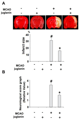 Figure 2 Juglanin reduced brain infarction volume and improved neurological dysfunction in a middle cerebral artery occlusion (MCAO) mice model. Mice were divided into 3 experimental groups: (1) Vehicle group; (2) juglanin group: mice were treated with juglanin (20 mg/kg body weight via oral gavage) (3) MCAO group: mice were subjected to cerebral ischemia for 2 h, followed by reperfusion for 24 h; (4) MCAO + juglanin: mice were treated with juglanin (20 mg/kg body weight via oral gavage) for 3 weeks before the MCAO experiment. (A) Representative images of brain infarction and quantification of infarction volume. (B) Neurological score graph of the three experimental groups (#P<0.01 vs vehicle group; *P<0.01 vs MCAO group).