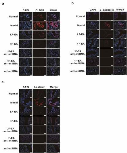 Figure 4. Effects of Electroacupuncture and miR-223-3p on Adhesion molecules via immunofluorescence assay Immunofluorescence assay on the E-cadherin expression in rats’ endometrium Immunofluorescence assay on the β-catenin expression in rats’ endometrium (C) Immunofluorescence assay on the CLDN1 expression in rats’ endometrium Data were presented in a manner of mean ± SD (n ≥ 3 experiments). Outcomes of *p < 0.05, **p < 0.01, ***p < 0.001, ****p < 0.0001 were determined via Student<apos;>s t-test (two groups) or one-way ANOVA, subsequently with Tukey<apos;>s test (more than two groups).(B) Protein quantitative map on the E-cadherin expressions in rats’ endometrium of each group (C) Protein quantitative map on the β-catenin expression in rats’ endometrium of each group (D) Protein quantitative map on the CLDN1 expression in rats’ endometrium of each group Data were presented in a manner of mean ± SD (n ≥ 3 experiments). Outcomes of *p < 0.05, **p < 0.01, ***p < 0.001, ****p < 0.0001 were determined via Student<apos;>s t-test (two groups) or one-way ANOVA, subsequently with Tukey<apos;>s test (more than two groups).