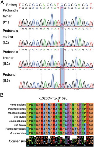 Figure 2. Homozygous mutation of CCDC9 was identified in the patient with severe asthenozoospermia. (A) Sanger sequencing confirmed the homozygous variant in CCDC9 gene of the patient. The red rectangles indicate the variant sites. The patient had the homozygous variant c.326C>T:p.Ser109Leu, while heterozygous mutation c.326C>T:p.Ser109Leu were identified in his father, his mother, and his elder brother. (B) Conservative analysis of the amino acid site affected by the homozygous variant in different species. The variant site and adjacent amino acids in CCDC9 are highly conserved between different species. Abbreviations: CCDC9, coiled-coil domain containing 9 (NC_000019.9, NM_015603.3, NP_056418.1).