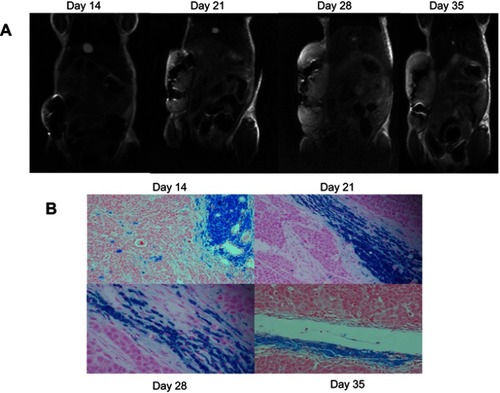 Figure 3 Coronal in vivo T2-weight images of labeled tumors over time and the corresponding PPB-stained sections. The tumor growth from iron-labeled SGC-7901 cells was monitored postinjection. The signal loss caused by the iron-labeled cells was evident at day 14 postinjection and persisted as the tumor developed. PPB-stained sections show the presence of iron-labeled cells within the tumor. (A) MR image of the labeled tumor. (B) PPB-stained section showing the iron content of labeled tumor over time.