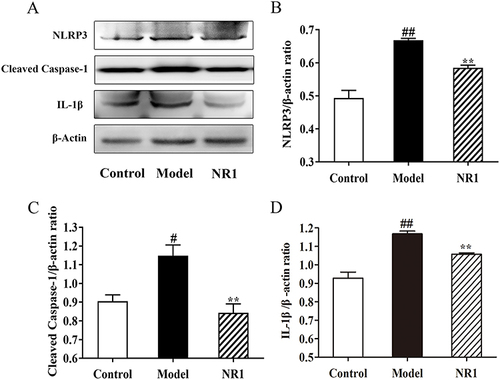 Figure 5 Notoginsenoside R1 inhibits activation and expression of NLRP3/Cleaved Caspase-1/IL-1β pathway in AS rats. (A) Expression levels of related protein expression were determined by the Western blot. Quantitative analysis of the expression of (B) NLRP3, (C) Cleaved Caspase-1, and (D) IL-1β, and β-Actin served as the internal control for protein analysis. All the values are represented by the means ± SD. ## p < 0.01 and # p < 0.05 versus control group; ** p < 0.01 and * p < 0.05 versus model group.