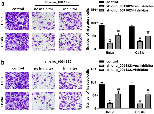 Figure 8. miR-613 inhibitor treatment inverted the effects of sh-circ_0001823 on the metastasis of the CC cells. A-B After sh-circ_0001823 as well as miR-613 inhibitor transfection, transwell assay was performed to detect the migration and invasion of the CC cells. **P < 0.01 VS control group. ##P < 0.01 VS sh-circ_0001823+ miR-613 inhibitor nc group.