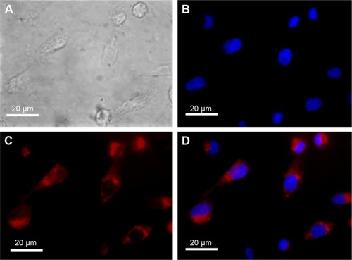 Figure 3 Fluorescence cell imaging.Notes: MDA-MB-231 cells were incubated with NIR-PluS NPs (NP-7; 100 nM) at 37°C for 24 hours, to allow NIR-PluS NP cell internalization before microscopy analysis. Representative cell images are shown. DAPI staining was carried out to visualize cell nuclei, which appear in blue, while NIR-PluS NPs appear in red. (A) Bright field image; (B) DAPI nuclear staining; (C) fluorescence emission; and (D) overlaid images (bar =20 µm).Abbreviations: NIR, near infrared; NIR-PluS NPs, NIR-emitting pluronic-silica nanoparticles.