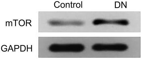 Figure 3. The protein expression of mTOR in DN group and control group. WB was utilized to measure the protein level of mTOR in DN group and control group.