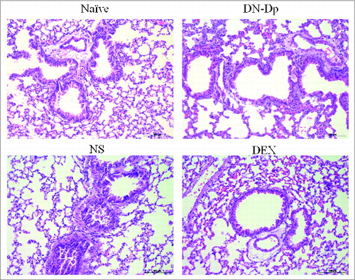 Figure 4. Lung pathology after LNIT with DN-Dp. Lung tissues were obtained 2 d after the second IT exposure to Der p crude extract in Der p-sensitized mice and examined by H and E staining (magnification 200x).