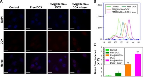 Figure 5 In vitro cellular uptake of PM@HMSNs-DOX.Notes: (A) CLSM images of MDA-MB-231 cells incubated with fresh medium, free DOX, PM@HMSNs-DOX, and PM@HMSNs-DOX with laser irradiation for 4 hours (DOX concentration: 5 µg/mL). Scale bar: 50 µm. (B) Flow cytometry analyses of MDA-MB-231 cells incubated with fresh medium, free DOX, PM@HMSNs-DOX, and PM@ HMSNs-DOX with laser irradiation for 4 hours. (C) The corresponding mean fluorescence intensity of MDA-MB-231 cells incubated with fresh medium, free DOX, PM@ HMSNs-DOX, and PM@HMSNs-DOX with laser irradiation for 4 hours. *P<0.05, **P<0.01, and ***P<0.001.Abbreviations: PM, polydopamine-coated MoSe2; HMSNs, hollow mesoporous silica nanoparticles; DOX, doxorubicin; CLSM, confocal laser scanning; microscopy.