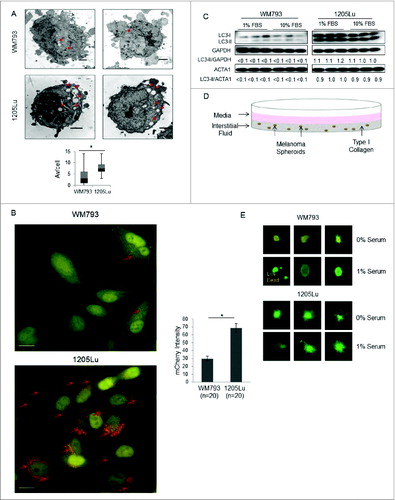 Figure 1 (See previous page). Autophagic flux of paired melanoma cell lines and cellular response to growth conditions. (A) Representative electron micrographs and box plots of mean AV/cell for WM793 and 1205Lu cells (n = 35) grown in complete medium in 2-dimensional cell culture; *P < 0.05 based on the Mann-Whitney test. Red arrows indicate intracellular autophagosomes. Scale bars = 2 μm. (B) Representative fluorescent images (60X) of mCherry-eGFP-LC3 infected 1205Lu and WM793 cells. Red puncta represent mCherry-positive structures that reflect active fusion of autophagosomes with functional lysosomes (red arrows). Scale bars = 50 μm. *P < 0.05 using the Student t test. (C) LC3 immunoblotting of WM793 and 1205Lu melanoma cells grown in media supplemented with either 10% or 1% FBS. (D) Schematic of 3D cell culture spheroid model illustrating secretome sample acquisition from the overlaying media and interstitial fluid (media in the collagen matrix) compartments. (E) Live/Dead Assay in 3-dimensional spheroids grown in a collagen matrix after exposure for 24 h to either serum-free media or media with 1% FBS. Green (live), calcein AM; red (dead), propidium iodide.