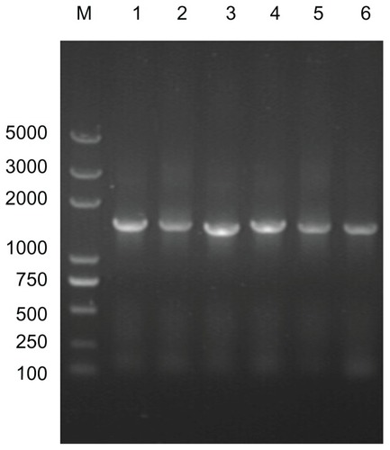 Figure 4 Analysis of target 16S rRNA gene sequences from different cultured calcifying nanoparticle samples. Lane M, DNA marker (Trans2K plus DNA marker); lane 1–6, genes from different calcifying nanoparticle samples cultured under the same conditions.