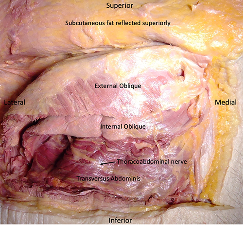 Figure 1 Cadaveric dissection revealing the nerves in the TAP.