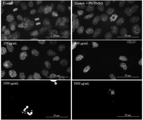 Figure 6. DAPI staining of MDA-MB-231 cells treated with different concentrations of Butterbur extract for 72 h. Bar is 50 µm.