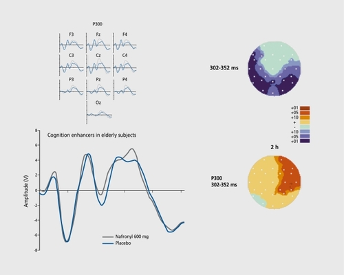 Figure 5. Age-related modifications in P300. Top left: Average curves for elderly (aged >55 years; blue lines) and young volunteers (gray lines) for several scalp positions. Top right: Statistical comparison between elderly and young subjects. Bottom left: Average cun/es in untreated (placebo) and treated elderly male volunteers. Bottom right: Statistical comparison showing significant improvement.