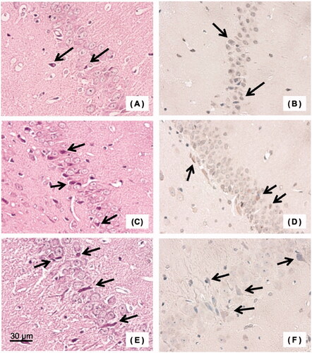 Figure 7. Histopathological examination of the brain (hippocampus) in the group of resuscitation from haemorrhagic shock. (A) Haematoxylin/eosin (HE) stained specimen of carbon monoxide-bound haemoglobin vesicles (CO-HbV) resuscitation group, (B) 8-hydroxy-2′-deoxyguanosine (8-OHdG) stained specimen of the CO-HbV resuscitation group, (C) HE stained specimen of the autologous whole blood (WB) resuscitation group, (D) 8-OHdG stained specimen of the WB resuscitation group, (E) HE stained specimen of the normal saline (NS) resuscitation group, and (F) 8-OHdG stained specimen of the NS resuscitation group. Arrows indicate some representative necrotic cells.