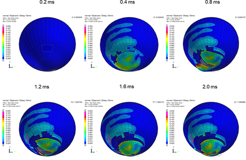 Figure 7 Sequential strain strength response of ocular surface of model eye upon airbag impact in 30°-gaze down position at 50 m/s with adhesion strength of scleral flap of 50%, shown at 0.4-ms intervals after 0.2 ms. Strain strength change is displayed in color as presented in the color bar scale (Figure 2).