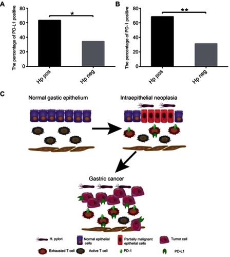 Figure 6 The relationship between Hp infection and PD-1, PD-L1 expression. (A) The percentage of PD-L1 positive in patients with Hp positive and negative; (B) The percentage of PD-1 positive in patients with Hp positive and negative. (C) Pattern diagram: Under chronic infection caused by Hp, the immune system may cause excessive damage of normal tissues. In order to avoiding excessive damage, PD-L1/PD-1 checkpoint inhibition is upregulated, but also reduces the tumor killing effect of T-cells and promotes the progress of gastric cancer.Note: *P<0.05 and **P<0.01.Abbreviations: Hp, Helicobacter pylori; PD-1, programmed death-1; PD-L1, programmed death-ligand 1.