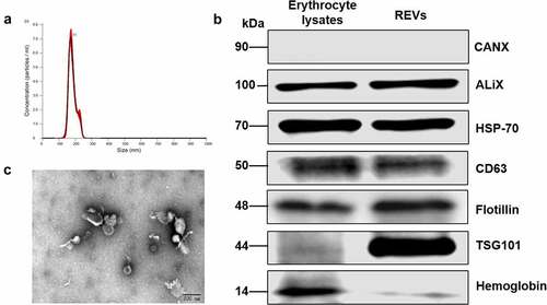 Figure 2. Characterization of erythrocyte-derived extracellular vesicles (REVs)