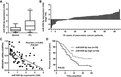 Figure 3 miR-939-5p expression in pancreatic cancer tissues. (A) miR-939-5p level was increased in pancreatic cancer tissues (n=70) compared with the adjacent-normal tissues (n=70). (B) miR-939-5p levels in 70 cases of pancreatic cancer patients (log2 T/N). (C) Pearson correlation scatter plots in pancreatic tissues (n=70). (D) Kaplan-Meier curve of pancreatic patients with high or low miR-939-5p levels analyzed by Log-rank (Mantel-Cox) test. ***P<0.001 compared with adjacent-normal.Abbreviations: PC, pancreatic cancer; N, adjacent-normal pancreatic tissues; T, pancreatic cancer tissues.