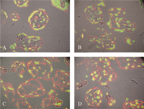 Figure 4. Placental galectin-1 immunofluorescence signal is increased in severe PE. (A) In term controls (38 weeks), the syncytiotrophoblast apical membrane, capillary endothelial cells, and stromal cells had the strongest galectin-1 immunopositivity. (B) In term SGA (39 weeks), galectin-1 immunopositivity was similar in its extent and pattern to that seen in controls. (C) In severe PE complicated with SGA (39 weeks), galectin-1 immunofluorescence signal was intense, predominantly in the trophoblastic layer, stromal cells, and the villous stroma. (D) Similarly, in severe PE without SGA (37 weeks), trophoblastic, stromal cell and stromal galectin-1 immunofluorescence staining was the strongest. Galectin-1 staining is shown in red, nuclei are in green (immunofluorescence confocal microscopy, 40× magnifications, fluorescence and differential interference contrast (DIC) combination images).