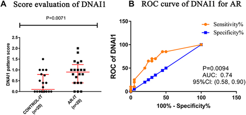 Figure 3 Score and ROC evaluation of DNAI1 for AR. (A) Higher DNAI1 score in patients with AR compared with control individuals. Median and first and third quartile values are indicated by the scale bar. (B) Predictive ability was calculated based on the AUC. DNAI1 score had an AUC of 0.74 and P = 0.0094. The cutoff value was 0.5833, and sensitivity and specificity were 70%.