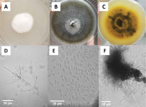 Fig. 2 (Colour online) Colonies of Verticillium isaacii grown on PDA. (a) Isolates form velvety, white colonies after 7 days. B) Colonies darken to black as time progresses to 14 days. (c) Some isolates, such as ECB4, produce yellow pigments in culture after 7 days. (D-F) Morphology of conidiophores and conidia of Verticillium isaacii. (d) Verticilliate conidiophores with 3 to 5 phialides. (e) Abundant hyaline conidia. (f) Dark microsclerotia about 1 mm in diameter. Scale bars = 25 µm