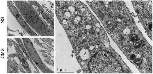 Figure 3. Ultrastructural appearance of hTM cells under CMS. Left panels: Representative lower magnification of NS or cells under CMS. Right panel: higher magnification of inset in stretched cells. Note that autophagosomes were not found within nuclei of NS or CMS cells. Nu, nucleus; V, vacuoles; AV, autophagic vacuole; ER, endoplasmic reticulum; M, mitochondria.