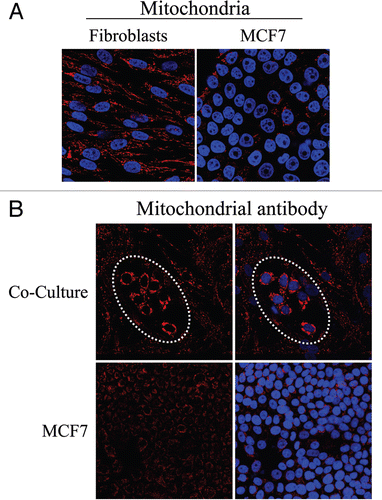 Figure 9 Fibroblasts induce increased mitochondrial mass in co-cultured MCF7 cells: Evidence that the conventional Warburg effect is an artifact. (A) In mono-cultures, mitochondria mass is lower in MCF7 cells as compared to fibroblasts. Homotypic cultures of MCF7 cells and hTERT-fibroblasts were immunostained with antibodies against an anti-intact mitochondrial membrane antibody (red). DAPI was used to stain nuclei (blue). Note that the mitochondrial mass is lower in mono-cultures of MCF7 cells, as compared to fibroblasts. Importantly, images were acquired using identical exposure settings. Original magnification, 40x. (B) Fibroblasts increase mitochondrial mass in co-cultured MCF7 cells. Co-cultures of hTERT-fibroblasts and MCF7 cells were fixed and immunostained with anti-intact inner mitochondrial membrane (red) antibody. DAPI was used to stain nuclei (blue). Note that co-culture with fibroblasts induces a significant increase in mitochondrial mass in the “central MCF7 cell colony”, encircled by a white dotted oval. Importantly, images were acquired using identical exposure settings. Original magnification, 20x.