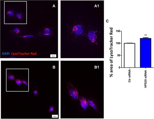 Figure 4 Lysosomal staining following VPS35 silencing in brain endothelial cells. Representative microscope images for control cells (A and A1 inset) and VPS35 siRNA-treated cells (B and B1 inset) labeled for VPS35 antibody (Cy5 channel pseudo-colored purple) and LysoTracker (LT) live cells dye (TXred channel, red). The distribution of acidic vesicles was visualized using fluorescence microscopy (Scale bar: 10 µm). Percentage area of LT (C) (**p < 0.01 vs Ctr siRNA). Results are mean ± SEM (N=3 individual experiments).