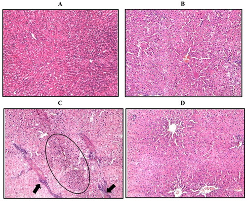 Figure 4. Representative image of hepatic sections stained with H/E. (A) Control group. (B) Control group treated with 5 mg/kg WRH-2412. (C) The liver architecture of HCC group showed massive break down of hepatic tissue together with hyperplastic nodules (Encircled) and apparent heteromorphism. (D) WRH-2412 treated rats showed greatly reduction in these histopathological features in the liver.