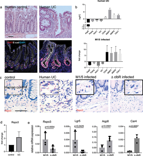 Figure 5. Epithelial changes seen in mice infected with WT M1/5 E. coli resemble those of human ulcerative colitis.