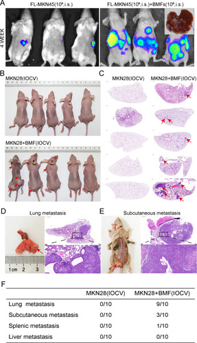 Figure 3 BMFs promote in vivo liver and lung metastasis of gastric cancer cells. The effect of BMFs on MKN45 cells liver metastasis in vivo was investigated using the mouse spleen injection liver metastasis model. The mice were monitored by IVIS imaging at the indicated time. FL-MKN45 cells (A) were injected i.s. alone or with BMFs into nude mice. Tumours are shown using IVIS imaging at four weeks. Metastatic liver tumours were confirmed using histology. Arrows indicated metastatic tumour in the liver tissues. The effect of BMFs on MKN28 cells lung metastasis in vivo was investigated using the IOCV mouse model. The rate of lung metastasis in the BMF and MKN28 cell co-injection or the MKN28 cell injection groups were observed after three months. Most of the mice in the co-injection group had lung metastasis (B–D, F), moreover, some developed subcutaneous (B, E) and spleen metastases (F). However, in the MKN28 cell injection group, no organ metastasis occurred (C, F).