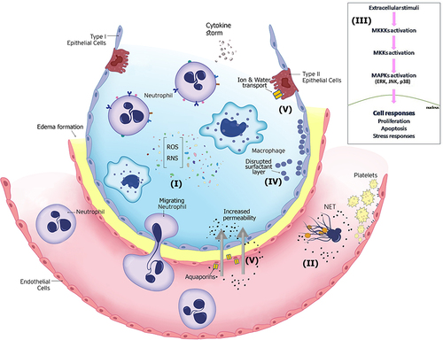 Figure 1 Key mechanisms of lung injury that contribute to the progression of acute lung inflammation/acute respiratory distress syndrome (ARDS).