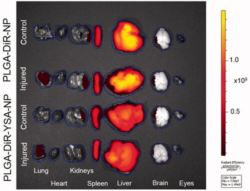 Figure 6. Tissue distribution of functionalized and non-functionalized nanoparticles visualized using IVIS imaging. Representative IVIS images of isolated tissues from mice, 3 days after intravenous injection of nanoparticles with and without YSA-functionalization. Images were obtained in the fluorescence mode using the Xenogen IVIS 2000 (PerkinElmer). The ICG excitation and emission filters were set to a 0.5 s exposure time. Tissue areas were marked by the contour selection method and the radiant efficiency was measured. ICG: indocyanine green.