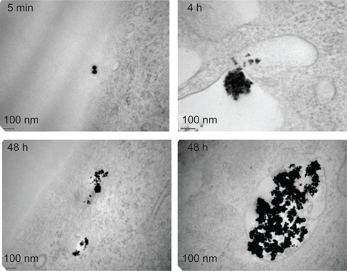 Figure 3 Subcellular localization of nanoparticles. Transmission electron microscopy was performed on human umbilical vascular endothelial cells (HUVEC) exposed to nanoparticles for the indicated times.